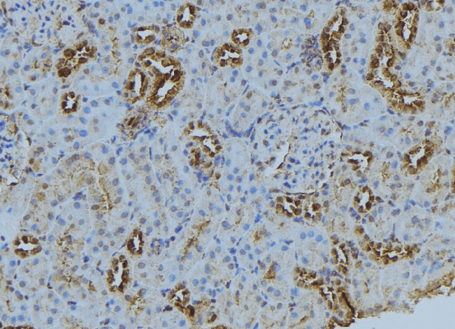 BBS5 Antibody
