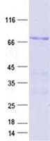 Human ZBTB37 Protein (Recombinant GST, N-terminus + His, C-terminus)