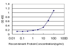 Monoclonal Mouse anti-Human PGGT1B Antibody (clone 5E4, IHC, IF, WB)
