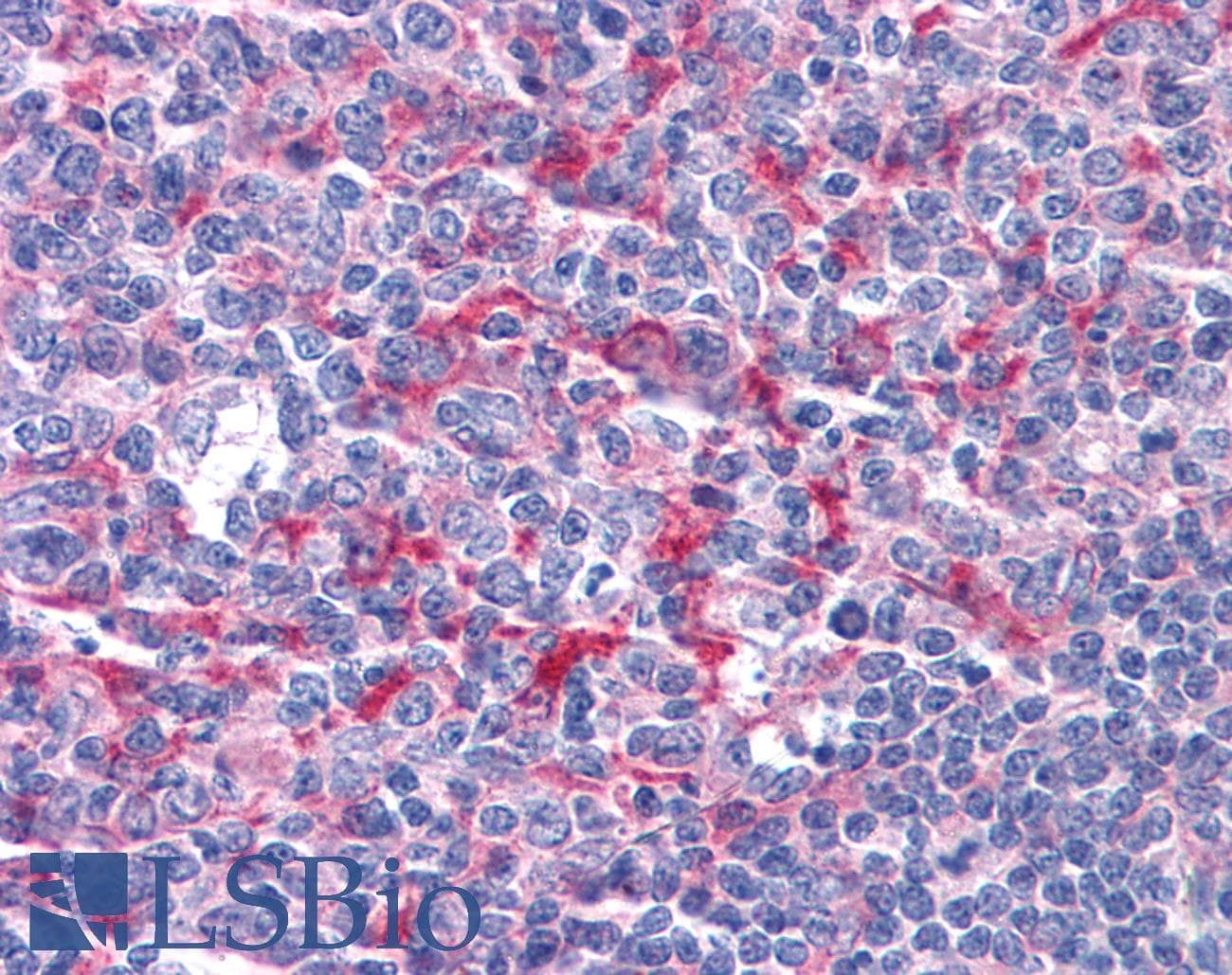 IHC-plus™ Polyclonal Goat anti-Human GABPB1 Antibody (aa198-210, IHC, IF, WB)