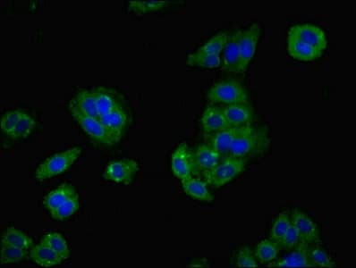 Polyclonal Rabbit anti-Human LY6H Antibody