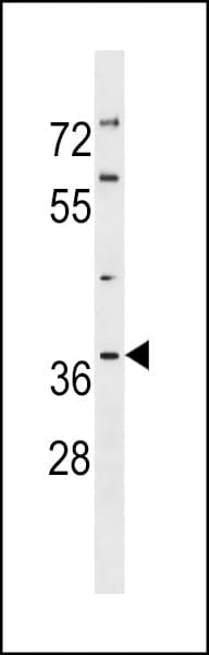 Polyclonal Rabbit anti-Human TP53I3 / PIG3 Antibody (aa174-203, WB)