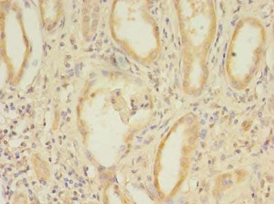CCDC112 / MBC1 Antibody (Coiled-coil domain)