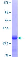 Human A2M / Alpha-2-Macroglobulin Protein (Recombinant GST, N-terminus)