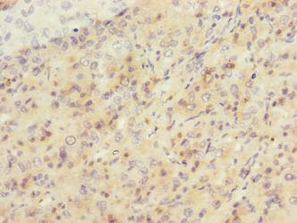 Polyclonal Rabbit anti-Human SIPA1L2 Antibody (IHC)