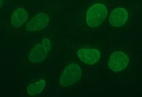 CD44 Antibody (clone OTI2E3)