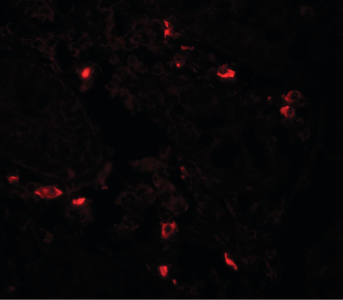 BTLA / CD272 Antibody