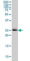 IHC-plus™ SPSB2 Antibody (clone 1E6)