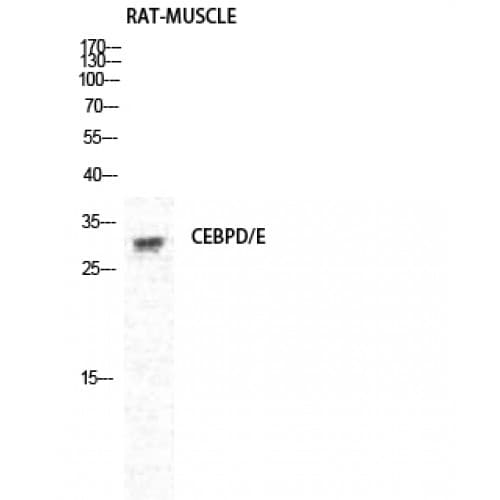 C/EBP Delta + C/EBP Epsilon Antibody (140-220 aa, C-terminal)