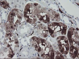 F13A1 / Factor XIIIa Antibody (clone OTI3F1)
