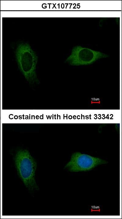 EVC2 Antibody (aa1246-1308)