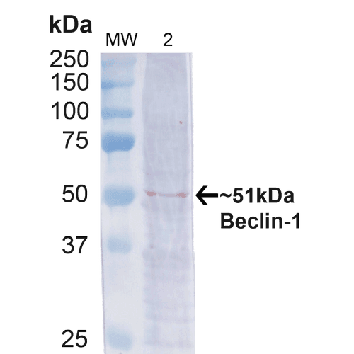 BECN1 / Beclin-1 Antibody (RPE)