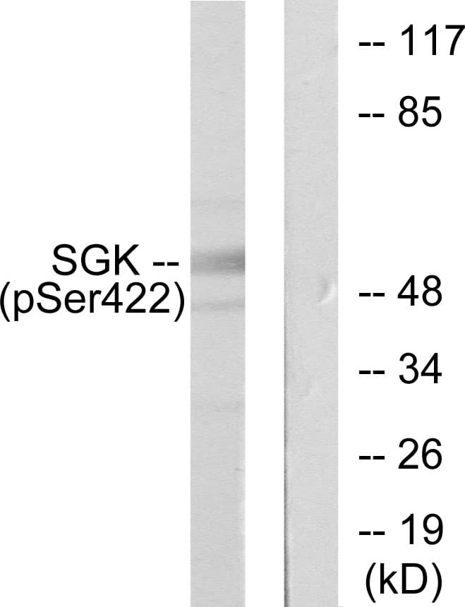 SGK1 / SGK Antibody (phospho-Ser422)