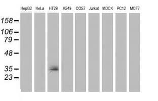 Monoclonal Mouse anti-Human VSIG2 Antibody (clone OTI2D8, IHC, IF, WB)
