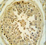Polyclonal Rabbit anti-Human LMX1B Antibody (aa175-202, IHC, WB)
