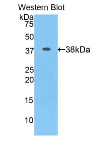 IFNA / Interferon Alpha Antibody (aa1-93)