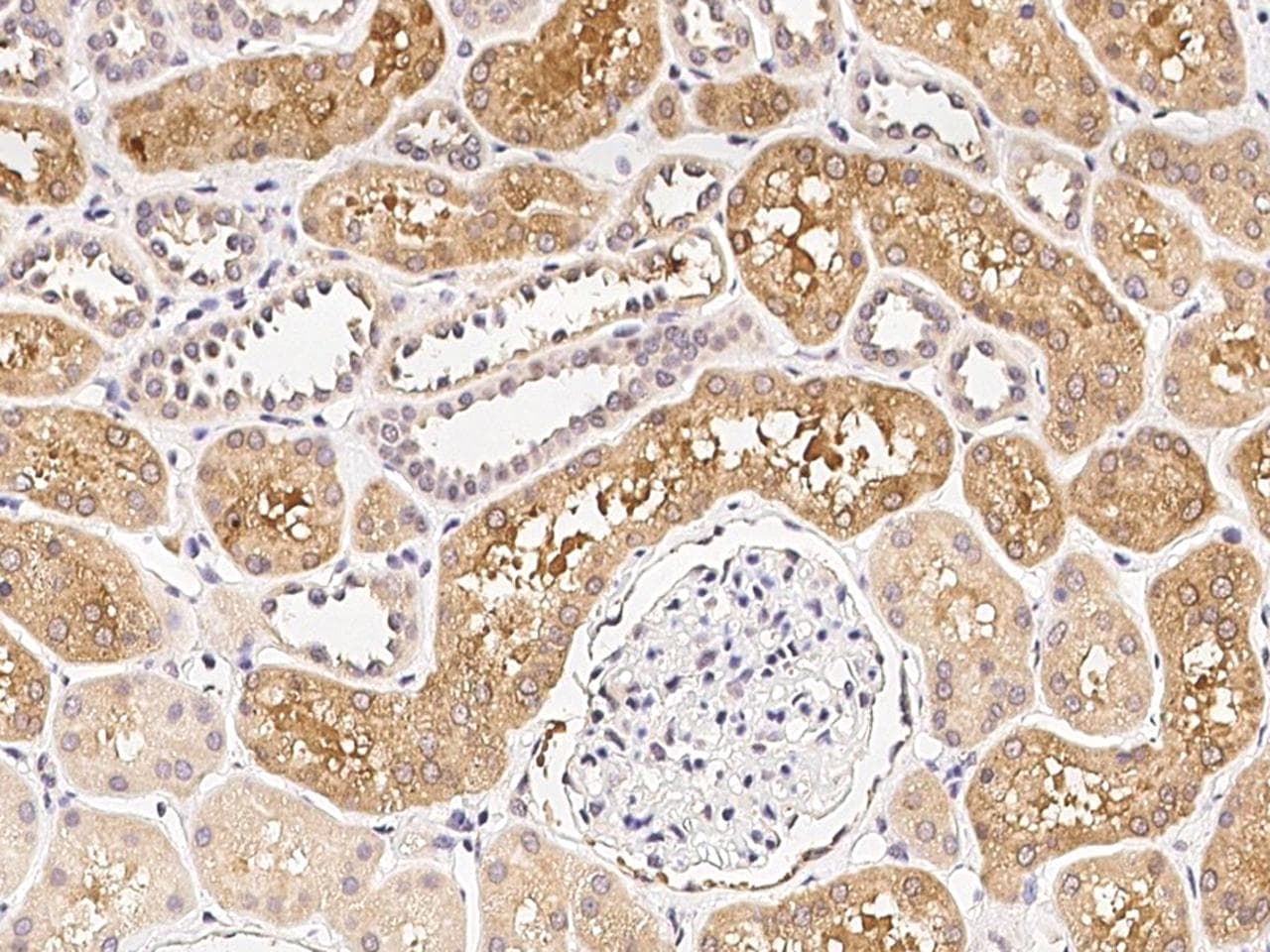 RARB / RAR Beta Antibody (Preservative Free)