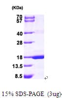 Human MAGOH Protein (Recombinant His)