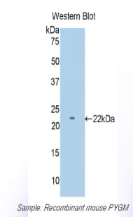 PYGM Antibody (aa11-187)