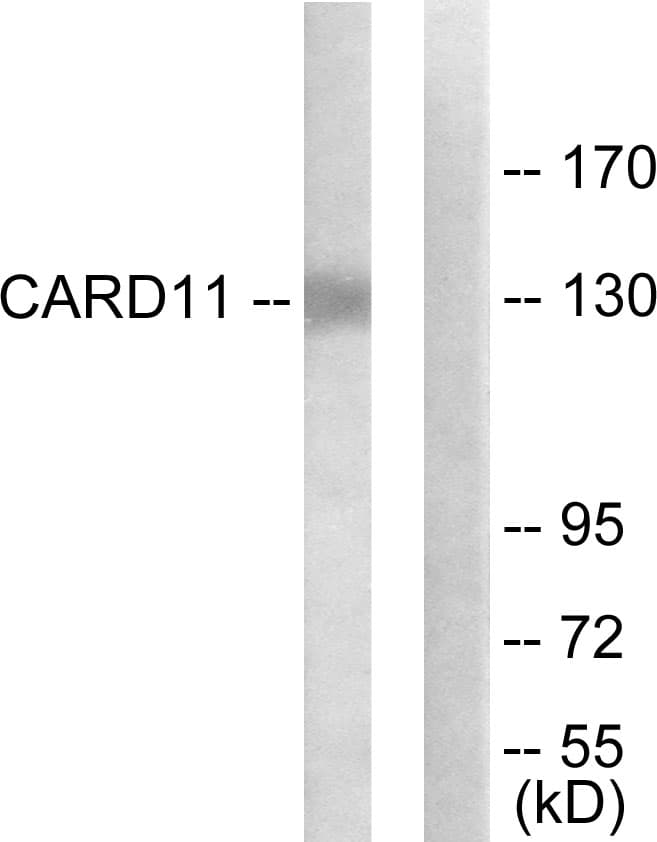 CARMA1 / CARD11 Antibody (aa10-59)