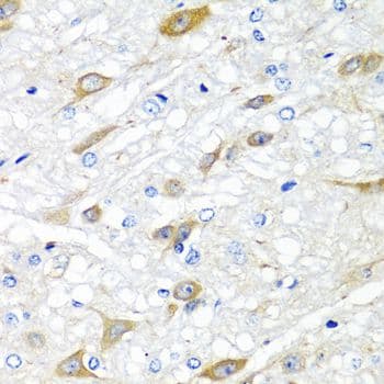 CPA6 / Carboxypeptidase A6 Antibody