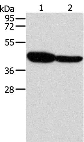 GLRA1/Glycine Receptor Alpha 1 Antibody