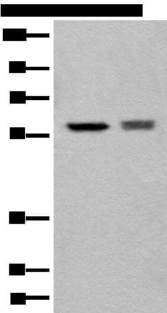 Polyclonal Rabbit anti-Human ATL3 Antibody (IHC, WB)
