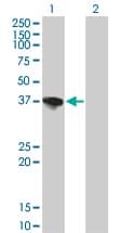 Monoclonal Mouse anti-Human SORD / Sorbitol Dehydrogenase Antibody (clone 4D3, IHC, WB)