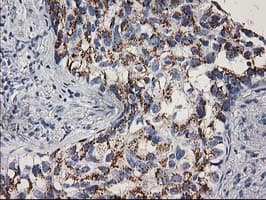 Monoclonal Mouse anti-Human CDK2 Antibody (clone OTI2D9, IHC, IF, WB)