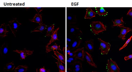 Monoclonal Mouse anti-Human EGF Antibody (clone 1H11, IF, WB)