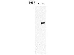 c-Met Antibody (phospho-Tyr1349/1356)