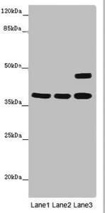 Polyclonal Rabbit anti-Human MR1 Antibody (IHC, IF, WB)