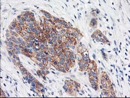 EIF2B3 Antibody (clone OTI1A4)