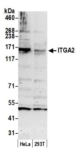 ITGA2 / CD49b Antibody (aa25-75)