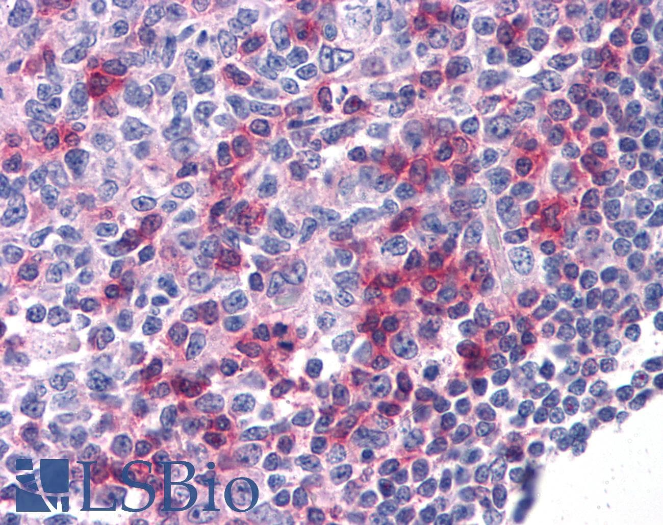 IHC-plus™ Monoclonal Mouse anti-Human CD69 Antibody (clone 8B6, IHC, WB)
