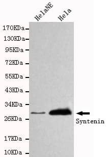 SDCBP / Syntenin Antibody