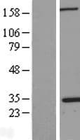 NPM1 / NPM / Nucleophosmin Protein (Over-Expression Lysate Myc-DDK (Flag))