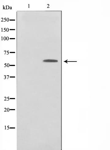 TP53 / p53 Antibody (phospho-Ser20)