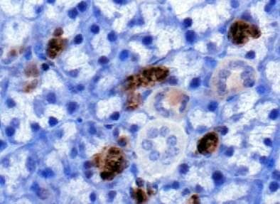 PLK5 Antibody (Biotin)