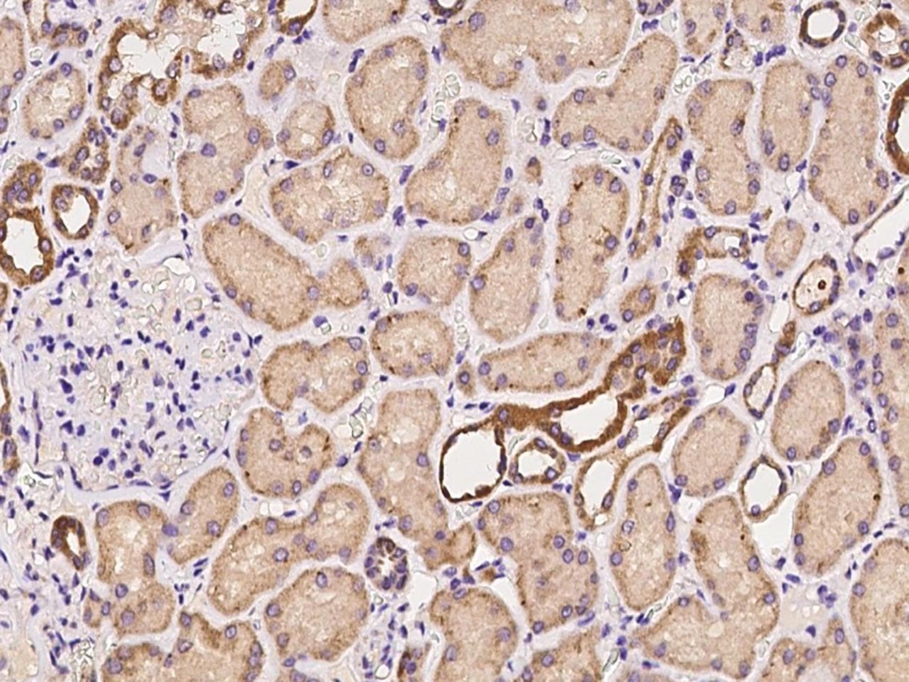 Polyclonal Rabbit anti-Human BABAM1 / HSPC142 Antibody (IHC)