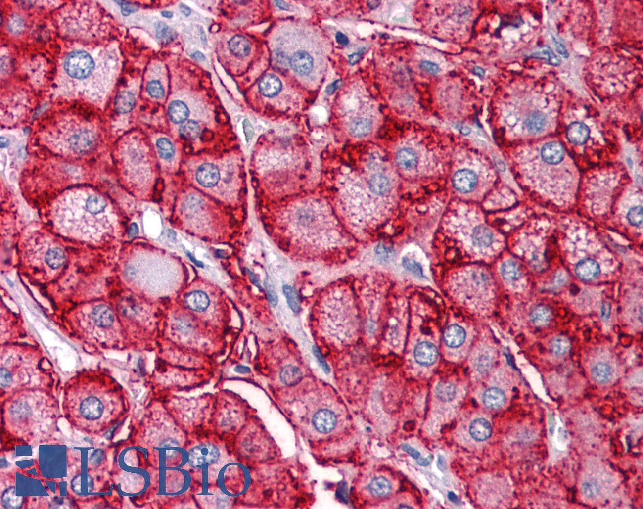 SCARB1 / SR-BI Antibody (Biotin)