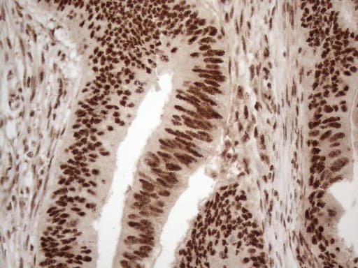 IRS1 Antibody (aa1-280, clone OTI3G10)