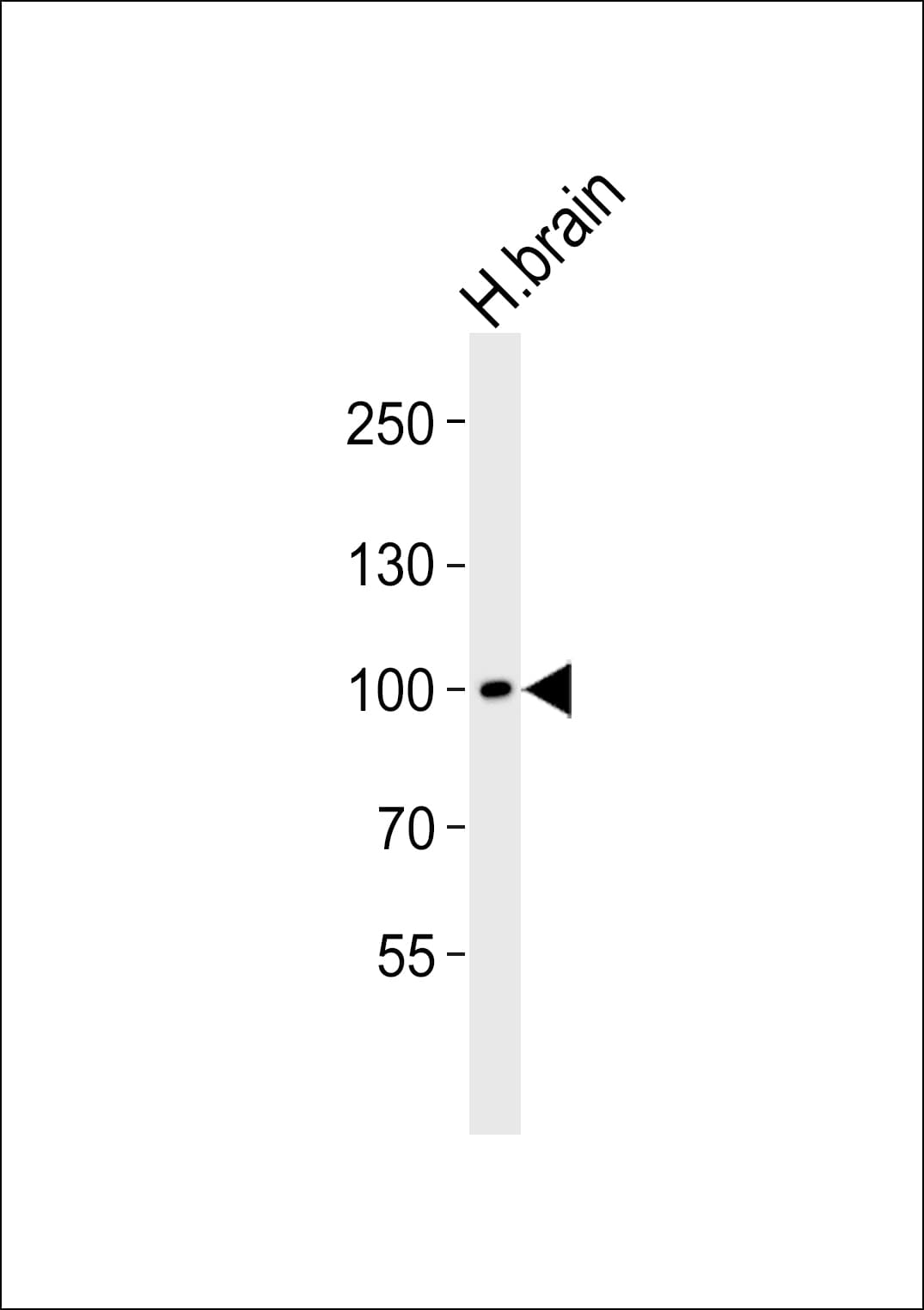 Polyclonal Rabbit anti-Human NEP / DDR1 Antibody (aa396-430, WB)