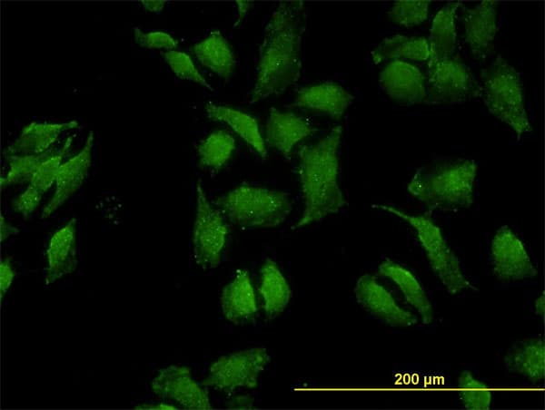OCLN / Occludin Antibody (clone 1G7)