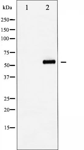 YAP / YAP1 Antibody (phospho-Ser127)
