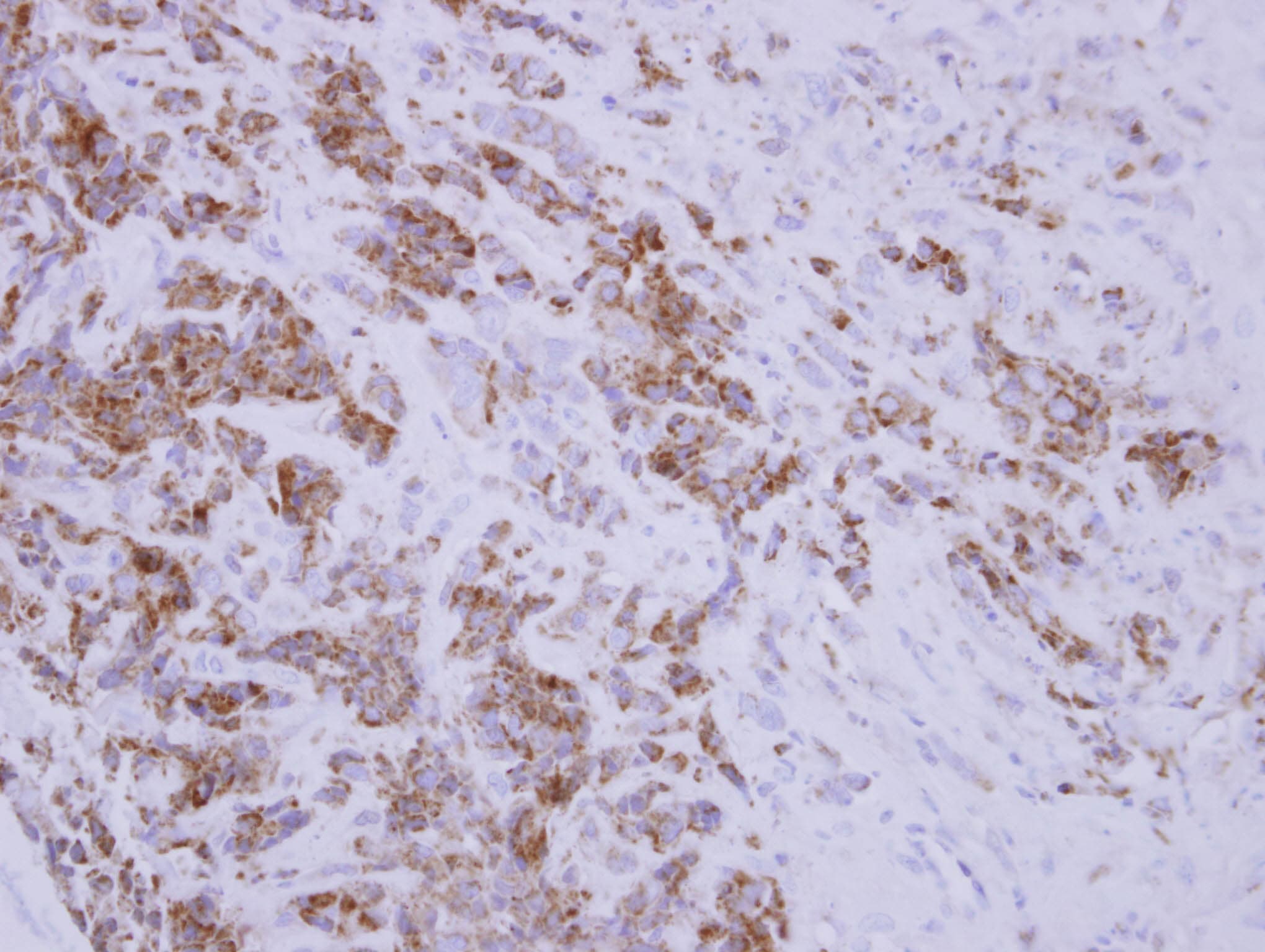 Polyclonal Rabbit anti-Human DNAJA3 / TID1 Antibody (IHC, IF, WB)