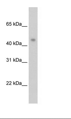 Polyclonal Rabbit anti-Human PRMT8 Antibody (C-Terminus, WB)