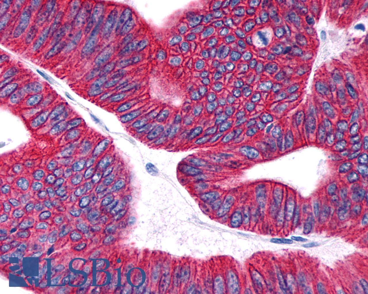 PathPlus™ Prostaglandin D2 Receptor Antibody (Extracellular Domain)