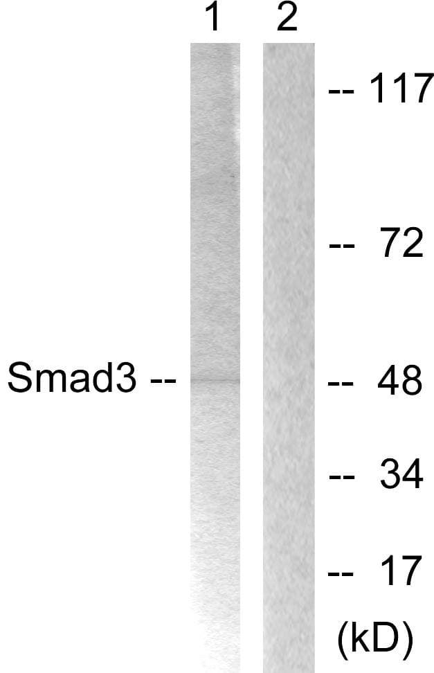 Polyclonal Rabbit anti-Human SMAD3 Antibody (p213, WB)
