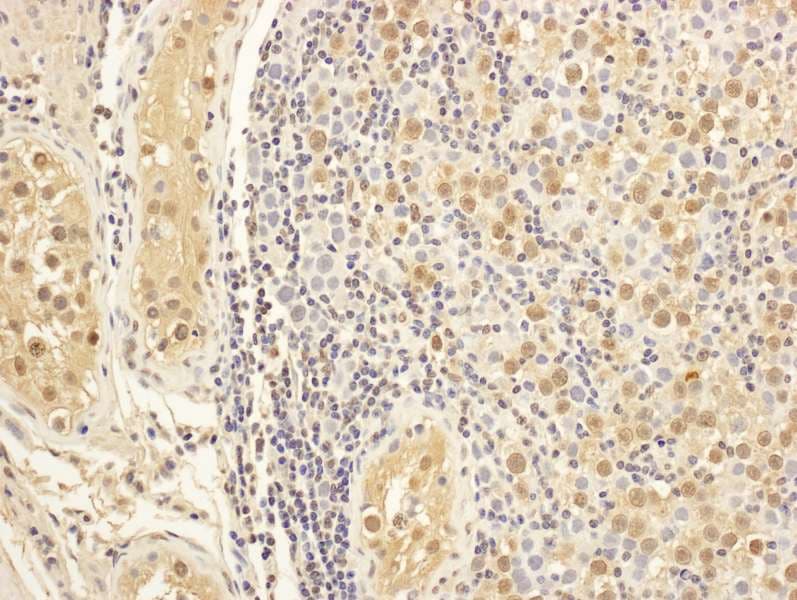 MAP1S Antibody (aa475-525)